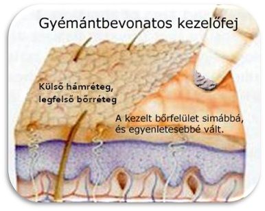 223_mikroderm.jpg 223_mikroderm.jpg
